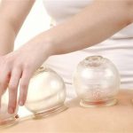 آیا خوندادن میتواند جایگزین “حجامت” شود