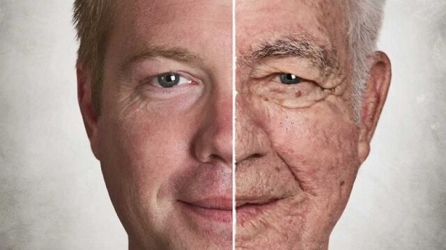 امکان ترمیم پوست افراد مسن با افزایش تحرک سلول‌های بنیادی